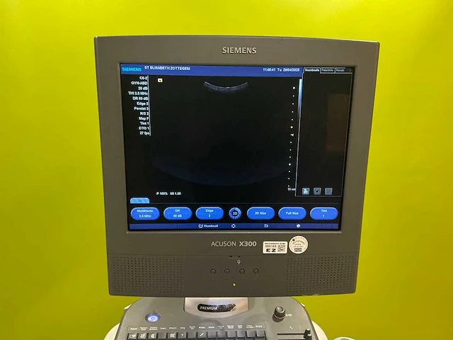 2009 siemens acuson x300 echografietoestel - afbeelding 2 van  9