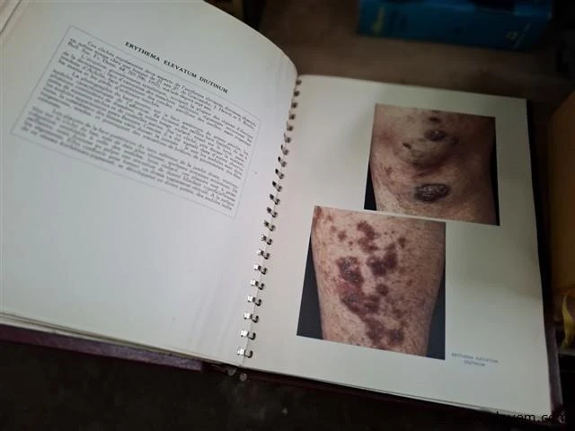3 antieke medische boeken - afbeelding 2 van  4