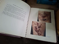 3 antieke medische boeken - afbeelding 2 van  4