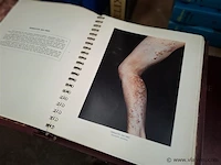 3 antieke medische boeken - afbeelding 3 van  4