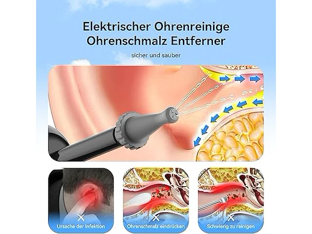 Elektrische oorsmeerverwijderaar - afbeelding 2 van  7