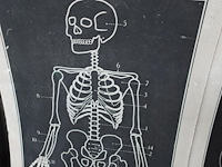9x vintage anatomische wandkaart - afbeelding 9 van  10