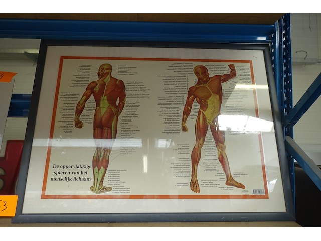 Anatomische poster in kader - afbeelding 1 van  3