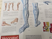 Lot 165 - lot medische toebehoren - afbeelding 11 van  11