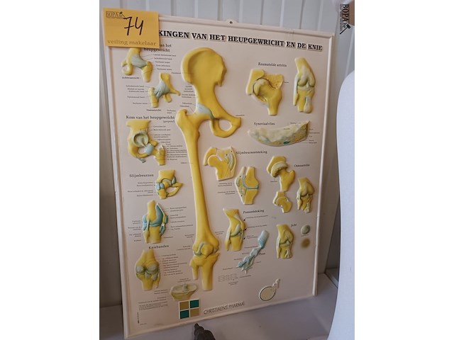 Lot 74 - medische pancaste in kunststof - afbeelding 1 van  3