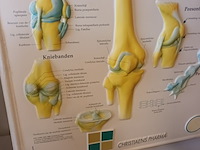 Lot 74 - medische pancaste in kunststof - afbeelding 2 van  3