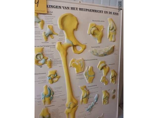 Lot 74 - medische pancaste in kunststof - afbeelding 3 van  3