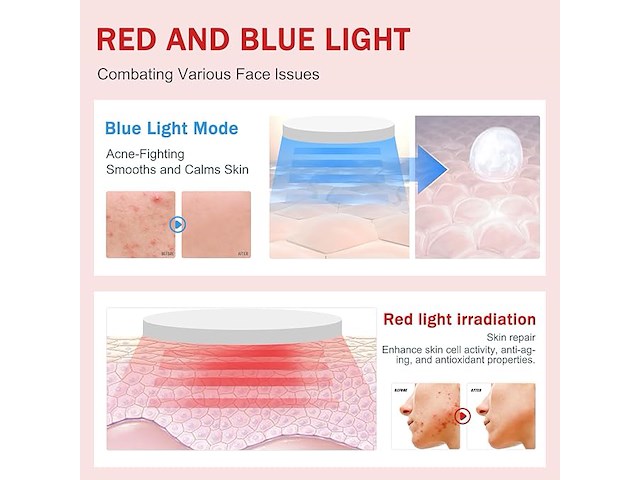 Yaasier elektrische v-vormige gezichtsmassager - afbeelding 4 van  4